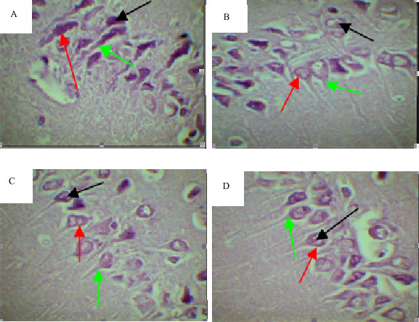 Image for - Neuroprotective Effect of Post Ischemic Treatment of Acetylsalicylic Acid on CA1 Hippocampus Neuron and Spatial Learning in Transient MCA Occlusion in Rat