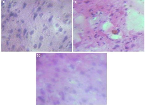 Image for - Antioxidant and Blood Brain Barrier Status in Cerebrospinal Fluid of Bacterial Meningitis Rat Model after Vancoplus Treatment