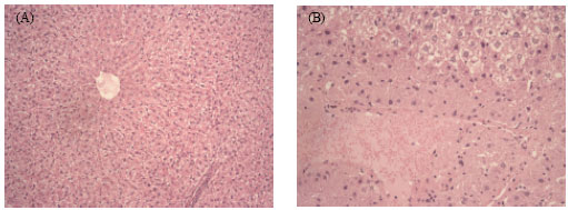 Image for - Combined Treatment of Rutin and Vitamin C Improves the Antioxidant Status in Streptozotocin-Induced Diabetic Rats