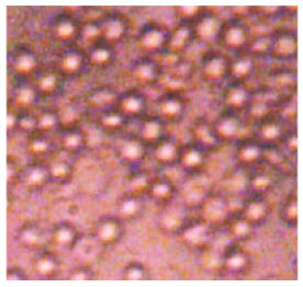 Image for - Anti Sickle Erythrocytes Haemolysis Properties and Inhibitory Effect of Anthocyanins Extracts of Trema orientalis (Ulmaceae) on the Aggregation of Human Deoxyhemoglobin S in vitro