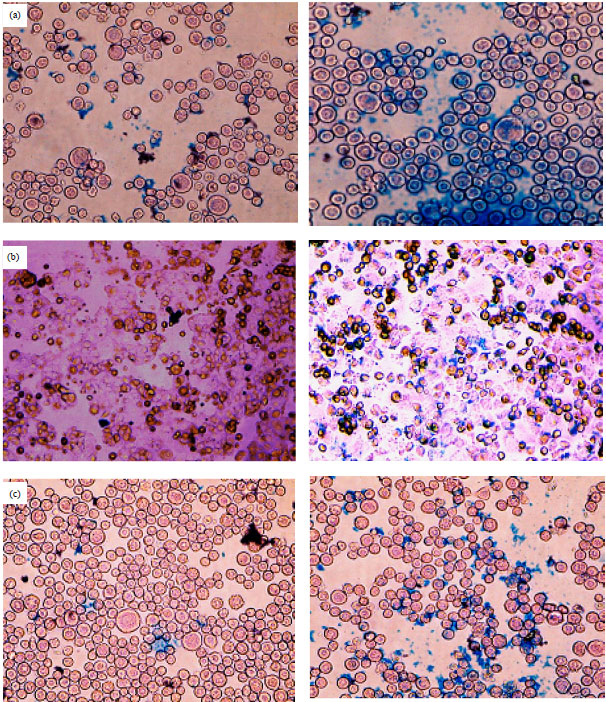 Image for - A Novel Method for Quantitative Analysis of Anti-MUC1 Expressing Ovarian Cancer Cell Surface Based on Magnetic Cell Separation