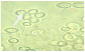 Image for - Activity of Scopulariopsis brevicaulis on Hyalomma anatolicum and Amblyomma lepidum (Acari : Ixodidae)