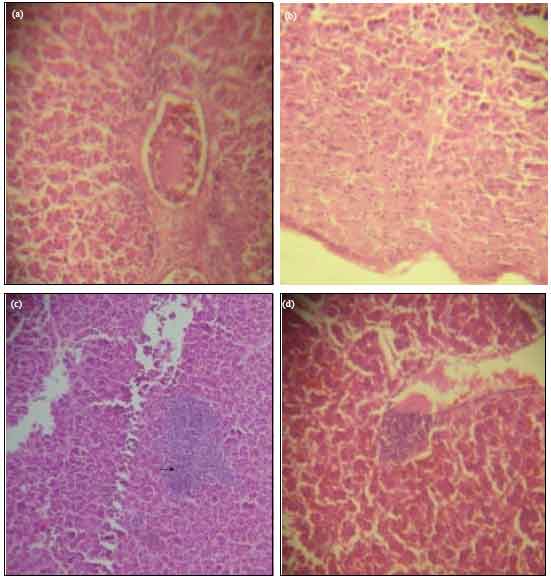 Image for - Histopathological Changes in the Liver of Broiler Chicks Fed Different Levels of Carbaryl