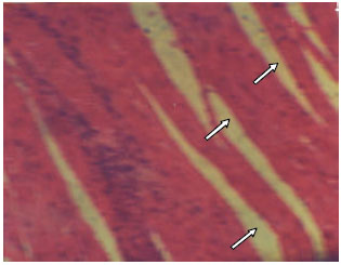 Image for - Influence of L-arginine on the Heart Histology and Function Markers of Metabolic Syndrome in Female Wistar Albino Rats