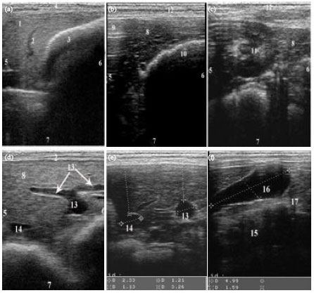 Image for - Contrast Radiographic, Ultrasonographic and Computed Tomographic Imaging Studies on the Abdominal Organs and Fatty Liver Infiltration of Zaraibi Goat
