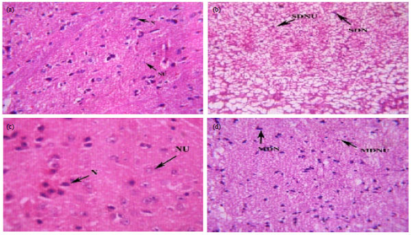 Image for - Therapeutic Effect of Bacopa monniera Against Aluminum Induced toxicity 
  in Medulla Oblongata of Albino rat