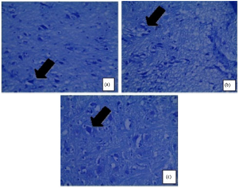 Image for - The Effects of Kolaviron (Methanolic Extract of Garcinia kola Seeds) on the Histoarchitectural Studies of the Hypothalamo-pituitary-gonadal  Axis in Female Wistar Rats