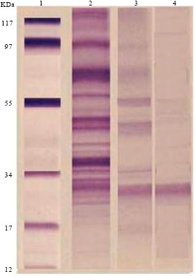 Image for - Fasciola gigantica Excretory/secretory Antigens as Possible Vaccine Candidates