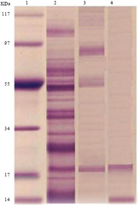 Image for - Fasciola gigantica Excretory/secretory Antigens as Possible Vaccine Candidates
