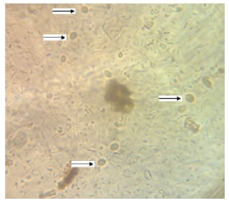 Image for - Prevalence of Intestinal Parasites among Children Attending the Daycare Centers of Ilam, Western Iran