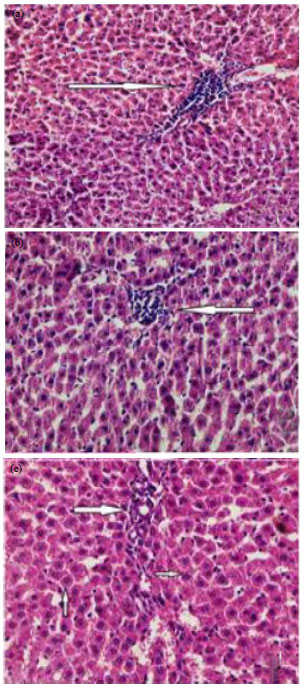 Image for - Protective Effect of Silymarin and Vitamine-E in Hepatotoxicity Induced by Valporic Acid in Albino Rats
