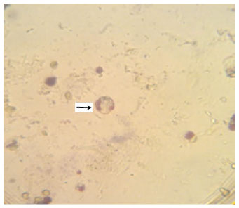 Image for - Prevalence of Intestinal Parasites among Children Attending the Daycare Centers of Ilam, Western Iran