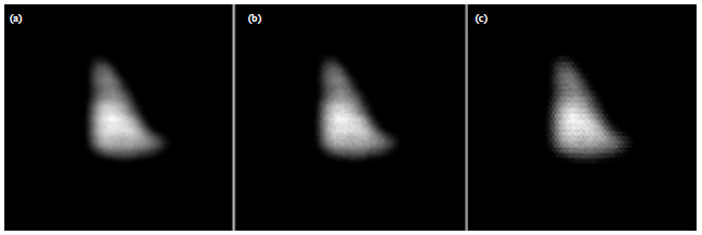 Image for - Liver Bremsstrahlung Imaging with Pure Beta Emitter