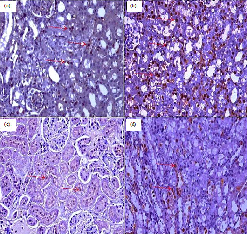 Image for - Preventive and Curative Effects of Zingiber officinale Extract against Histopathological and Ki-67 Immunohistochemical Changes of Glycerol-Induced Acute Renal Failure in Rat