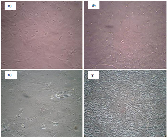 Image for - Healing Effect of Conditioned Media from Bone Marrow-Derived Stem Cells in Thioacetamide-induced Liver Fibrosis of Rat