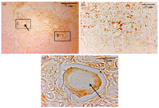 Image for - Mouse Mesonephros in Fetus Period is Necessary for Differentiation of Primordial Germ Cells in Ectopic Kidney Capsule