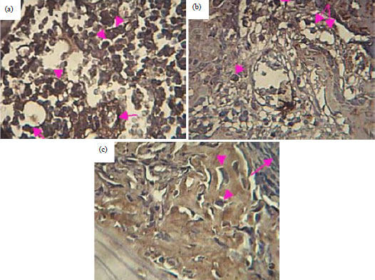 Image for - Effect of Flaxseed Application on Bone Healing in Male Rats, Histological and Immunohistochemical Evaluation of Vascular Endothelial Growth Factor