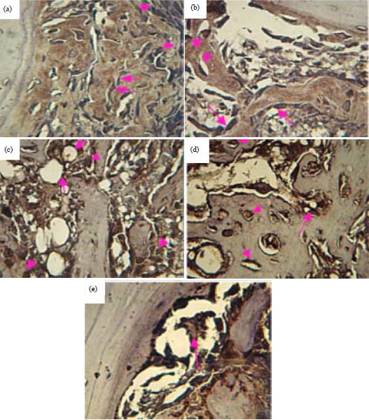 Image for - Effect of Flaxseed Application on Bone Healing in Male Rats, Histological and Immunohistochemical Evaluation of Vascular Endothelial Growth Factor