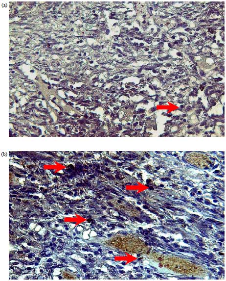 Image for - Effects of Bone Marrow Mesenchymal Stem Cell to Transforming Grow Factor-β3 and Matrix Metalloproteinase-9 Expression in Burns
