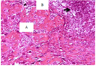 Image for - Role of Mesenchymal Stem Cells in Bone Healing of Rat Bisphosphonate-induced Osteonecrosis of the Jaw