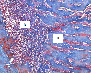 Image for - Role of Mesenchymal Stem Cells in Bone Healing of Rat Bisphosphonate-induced Osteonecrosis of the Jaw