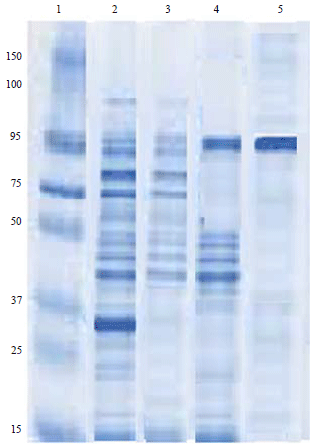 Image for - Application of Latex Agglutination and Sandwich ELISA inDetection of Human Hydatidosis
