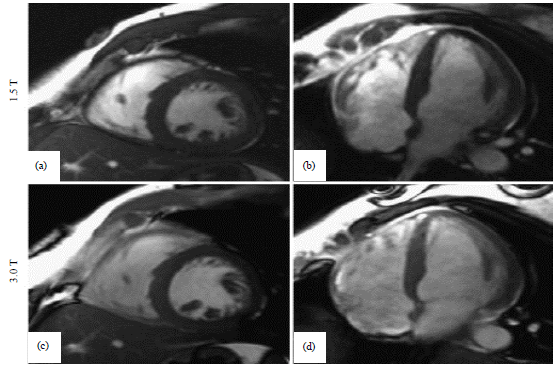 Image for - Cardiac Magnetic Resonance Imaging in the Diagnosis of Ischemic Heart Disease