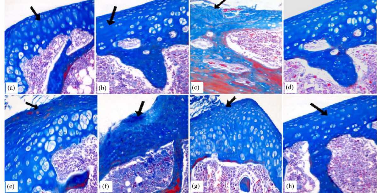 Image for - Fraxetin with Low Dose Methotrexate Ameliorates Pristane-Induced Arthritis in Rats: Histological and Immunohistochemical Study