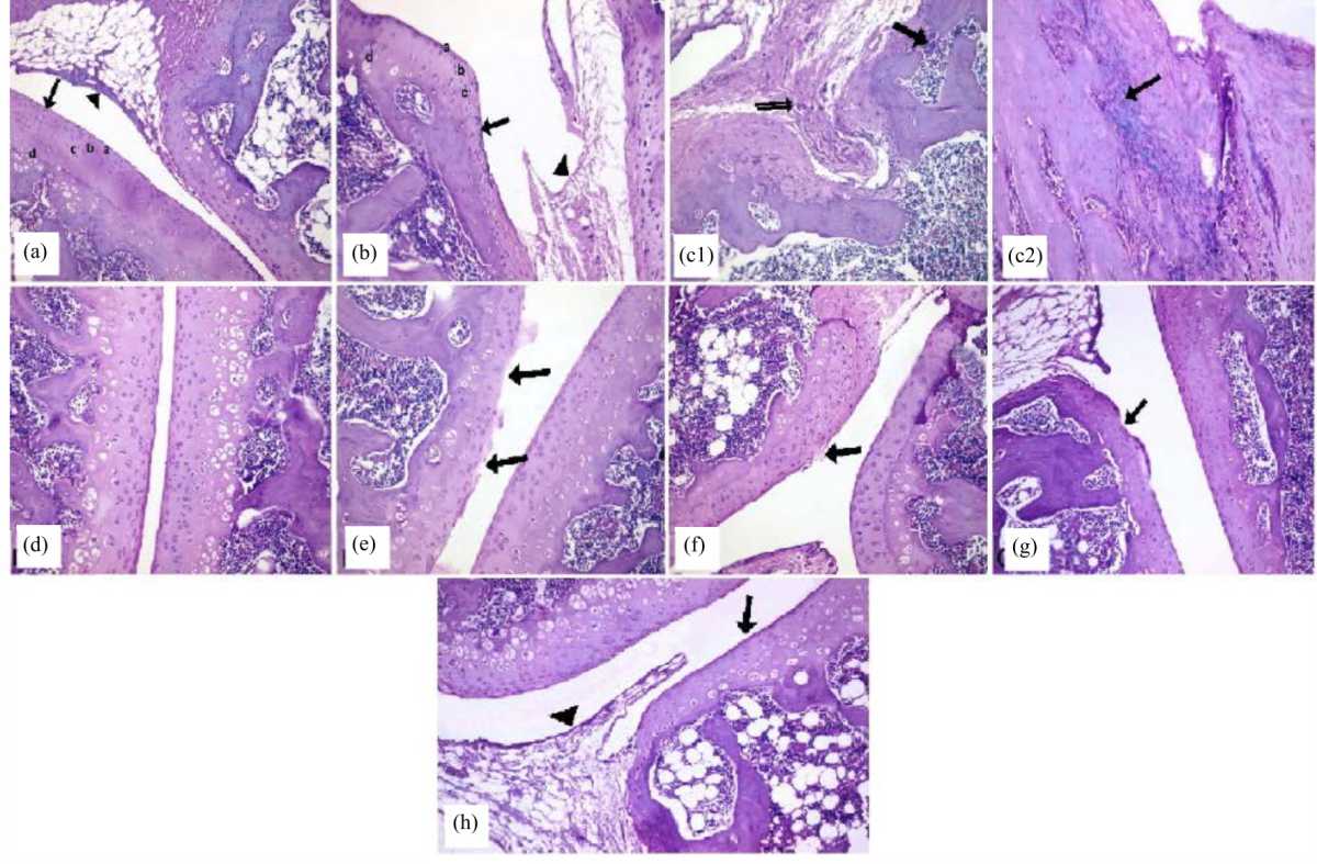 Image for - Fraxetin with Low Dose Methotrexate Ameliorates Pristane-Induced Arthritis in Rats: Histological and Immunohistochemical Study