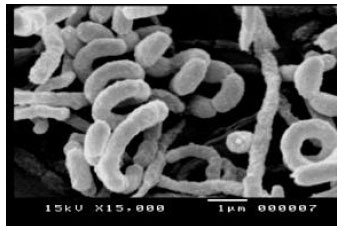 Image for - Identification of Luteomycin like Antibiotic Produced by Streptomyces tanashiensis AZ-C442 Isolated from Luxor Governorate at Upper Egypt
