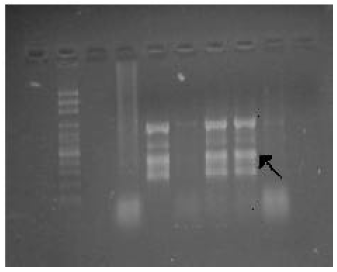 Image for - PCR Detection of Staphylococcal Enterotoxin A and B Genes in Staphylococcus  aureus Isolated from Salted Fermented Fish