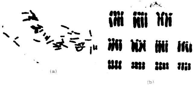 Image for - Chromosomal Heteromorphy in the Karyotypes of Three Local Cultivars of Hippeastrum vittatum (Amaryllidaceae)