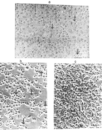 Image for - Functional Studies of the Sendai Virus HN Gene Product in BHK-21 Cells