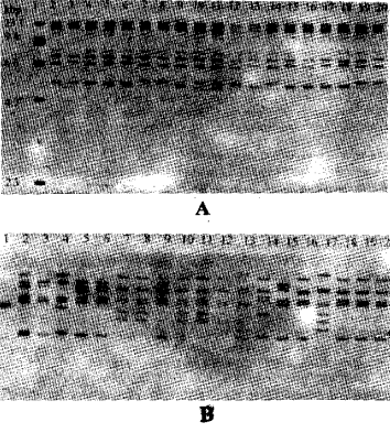 Image for - Comparative Analysis of Salmonella typhi by rRNA Gene Restriction and Phage Typing
