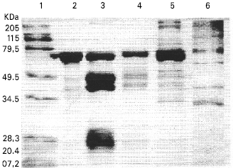 Image for - Natural Variation among Rice Yellow Stem Borer, Scirpophaga incertulas (Walker) and Rice Leaffolder, Cnaphalocrocis medinalis (Guenee) Populations to Bacillus thuringiensis δ-endotoxins