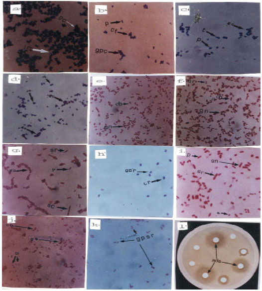 Image for - In vitro Antibiotic Susceptibility of Bacterial Species, Identified from Uteri of Slaughtered Goats