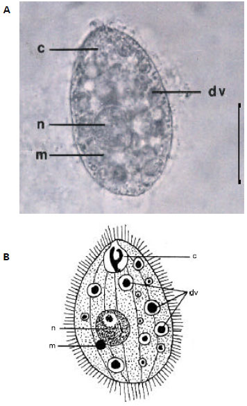 A Study on Tetrahymena pyriformis (Holotrichous) and Epistylis sp ...