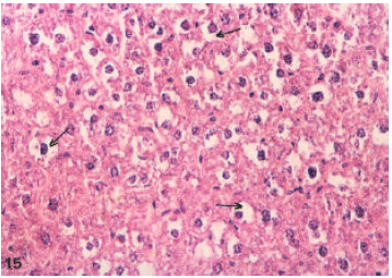 Image for - Histological, Ultrastructural and Immunohistochemical Studies of the Low Frequency Electromagnetic Field Effect on Thymus, Spleen and Liver of Albino Swiss Mice