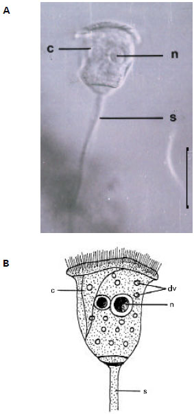 Image for - A Study on Tetrahymena pyriformis (Holotrichous) and Epistylis sp. (Peritrichous) Found on Freshwater Leech, Nephelopsis obscura