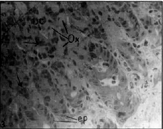 Image for - Light and Electron Microscopic Studies on the Effect of Tenoxicam on the Stomach of the Mouse