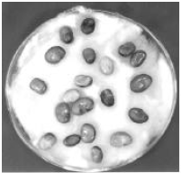 Image for - Aflatoxins Production by Aspergillus flavus, Isolated from Different FoodstuffsCommonly Used in Jeddah Region, Saudi Arabia