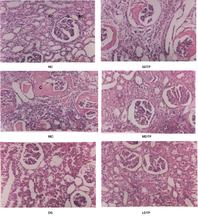 Image for - Effect of Tea Polyphenols on Masugi Nephritis of Rabbit