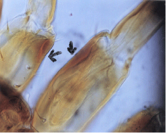 Image for - Biometrical Studies of Ectoparasite Bovicola ovis Schrank (1781) (Phthiraptera-Insecta) in Sheep of Balochistan, Pakistan