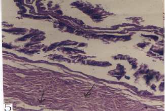 Image for - Effect of Acanthocephalan Infection on the Intestinal Wall of Snake (Naja naja): a Histopathological Parameter