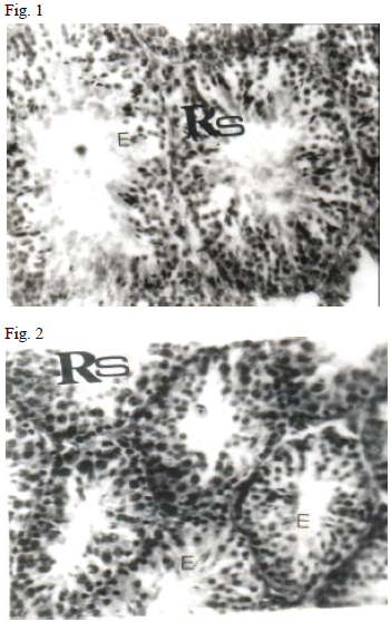 Image for - Histological Evidence of Retardation of Spermatogenesis in Mice in Experimentally Induced Fetal Alcohol Syndrome