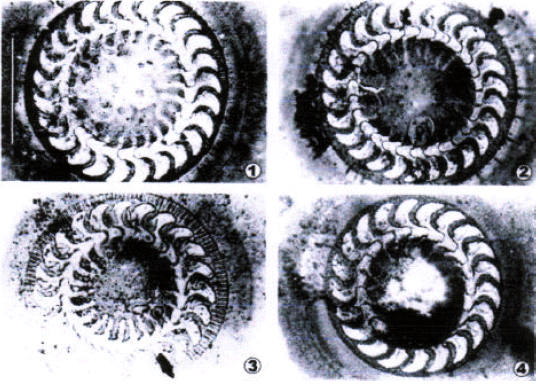 Image for - Trichodina gulshae sp. n. (Cilioiphora : Trichodinidae) from the Gangetic Mystus, Mystus cavasisus (Hamilton-Buchanan, 1822) (Bagridae) in Chittagong