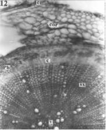 Image for - Anatomy of the Root of Pigeonpea (Cajanus cajan)