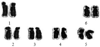 Image for - Karyotype Analysis of Some Legume Species (Vicia noeana Boiss. and Lathyrus sativus L.) Collected From Native Vegetation