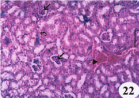 Image for - Evaluation of the Protective Effect of Two Antioxidative Agents in Mice Experimentally Infected with Schistosoma mansoni: Haematological and Histopathological Aspects