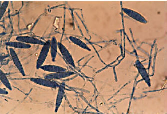 Image for - Isolation and Characterization of a Dermatophyte, Microsporum gypseum from Poultry Farm Soils of Rewa (Madhya Pradesh), India